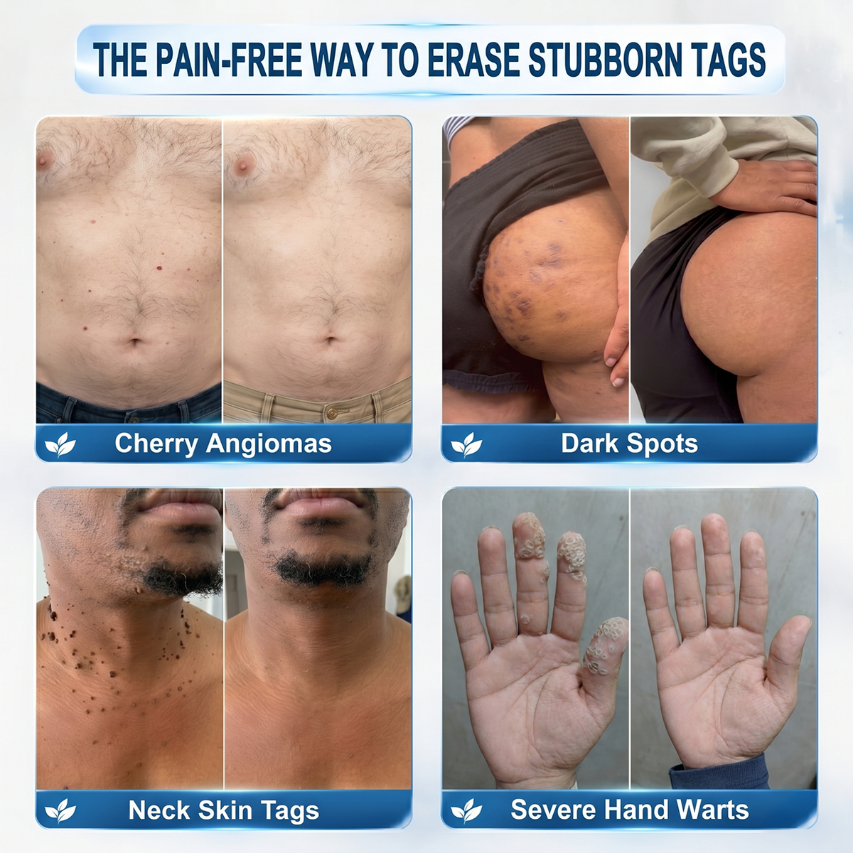 𝐏𝐡𝐚𝐫𝐦𝐚𝐜𝐢𝐬𝐭 𝐑𝐞𝐜𝐨𝐦𝐦𝐞𝐧𝐝𝐞𝐝 🍉🍉𝑯𝗲𝙖𝐥𝒓𝗶𝙯𝗲® 7-𝐷𝑎𝑦 𝗧𝐚𝐠 & 𝗦𝗽𝐨𝐭 𝐄𝐫𝒂𝒔𝒆𝒓🪄(Zero 𝐏𝐚𝐢𝐧, Zero 𝐒𝐜𝐚𝒓𝒔 Rollerball)👩‍⚕️